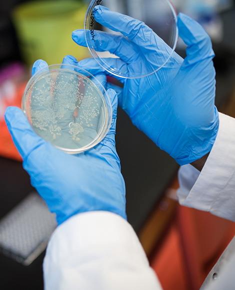 Hands with blue gloves holding petri dish